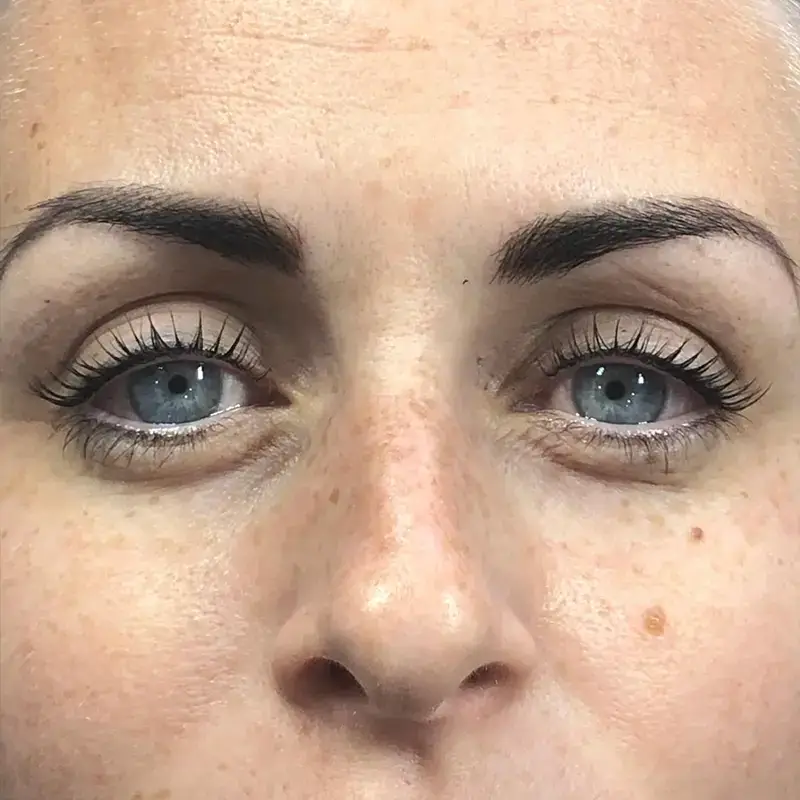 Close-up of a person's face showing blue eyes, long lashes, shaped dark eyebrows, and fair skin with freckles and moles. The image focuses on the area between the forehead and upper lip.