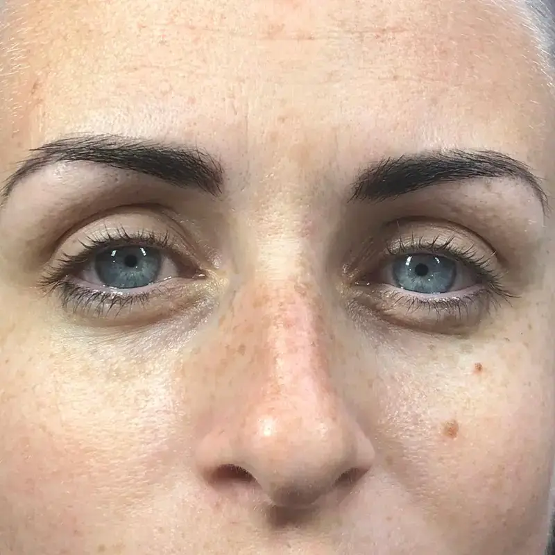 Close-up of a person's face, focusing on light blue eyes, dark well-groomed eyebrows, and clear skin with some freckles and a mole near the right cheek.